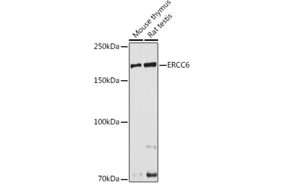 Western Blot - Anti-CSB Antibody (A306681) - Antibodies.com