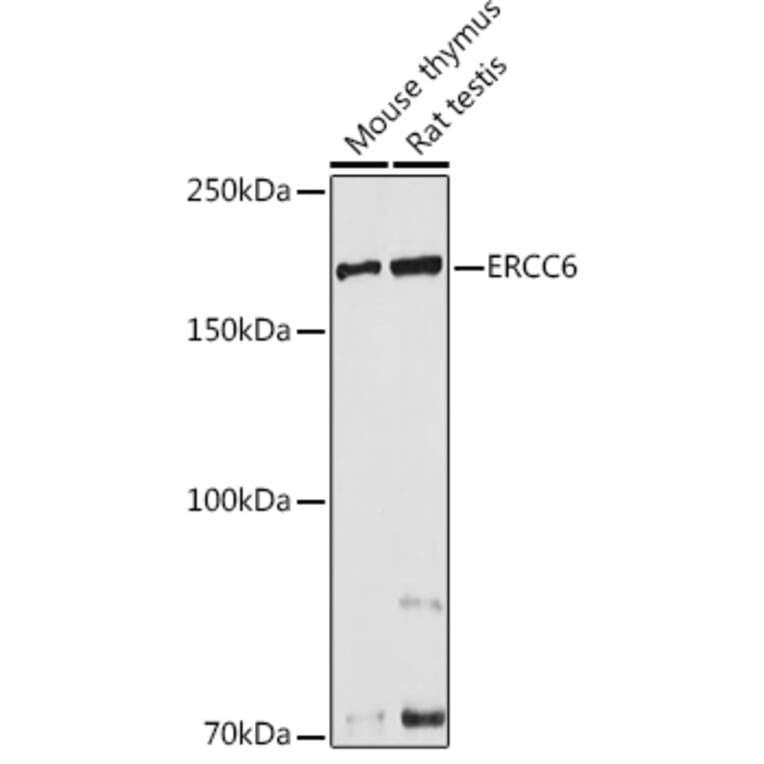 Western Blot - Anti-CSB Antibody (A306681) - Antibodies.com