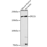 Western Blot - Anti-CSB Antibody (A306681) - Antibodies.com