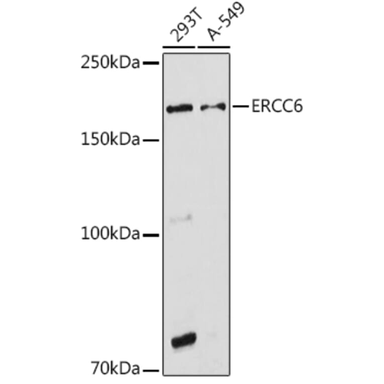 Western Blot - Anti-CSB Antibody (A306681) - Antibodies.com