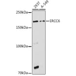 Western Blot - Anti-CSB Antibody (A306681) - Antibodies.com