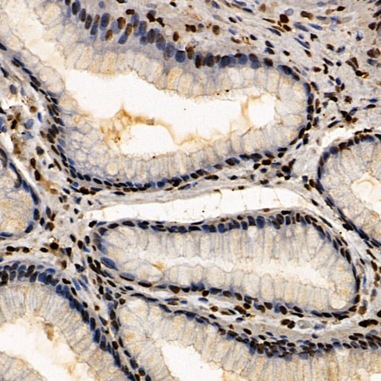 Immunohistochemistry - Anti-CSB Antibody (A306681) - Antibodies.com