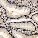 Immunohistochemistry - Anti-CSB Antibody (A306681) - Antibodies.com