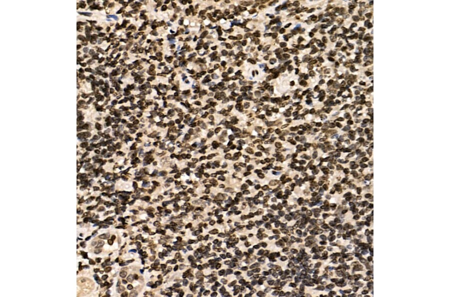 Immunohistochemistry - Anti-CSB Antibody (A306681) - Antibodies.com