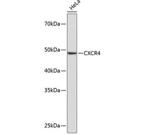 Western Blot - Anti-CXCR4 Antibody [ARC0381] (A306682) - Antibodies.com