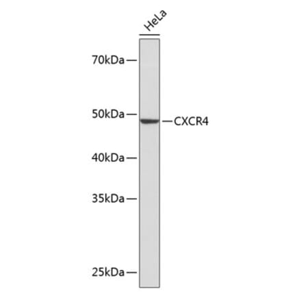Western Blot - Anti-CXCR4 Antibody [ARC0381] (A306682) - Antibodies.com