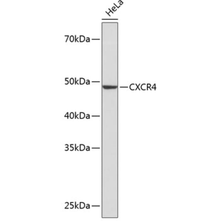 Western Blot - Anti-CXCR4 Antibody [ARC0381] (A306682) - Antibodies.com