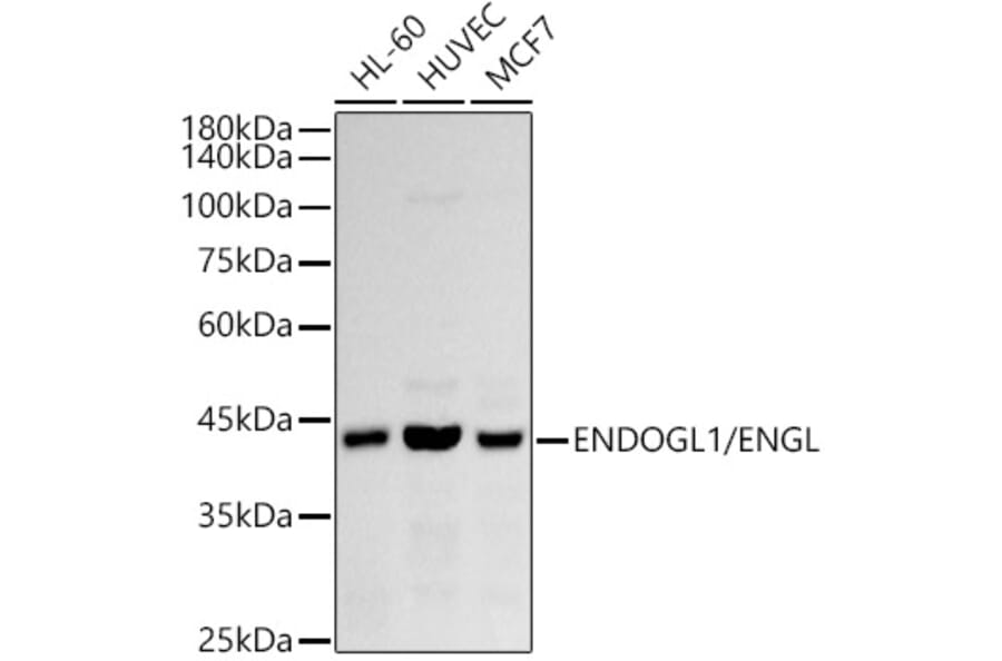 Western Blot - Anti-ENDOGL1/ENGL Antibody [ARC2827] (A306683) - Antibodies.com
