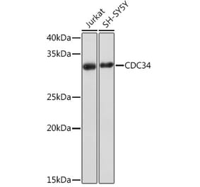 Western Blot - Anti-Cdc34 Antibody [ARC1742] (A306686) - Antibodies.com