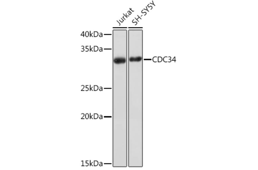 Western Blot - Anti-Cdc34 Antibody [ARC1742] (A306686) - Antibodies.com