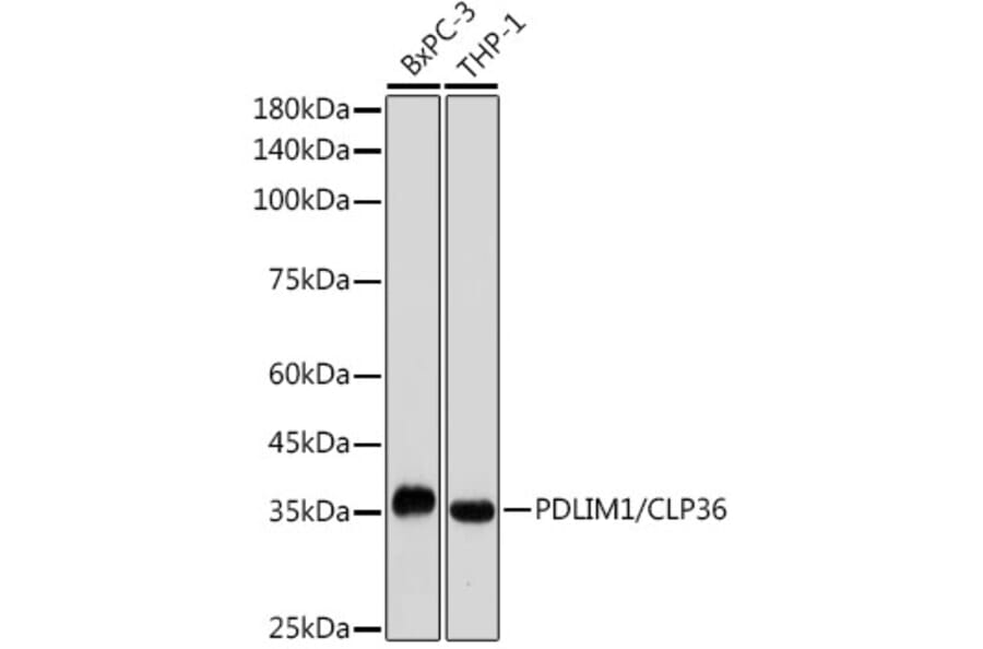 Western Blot - Anti-PDLIM1/CLP36 Antibody [ARC2379] (A306687) - Antibodies.com