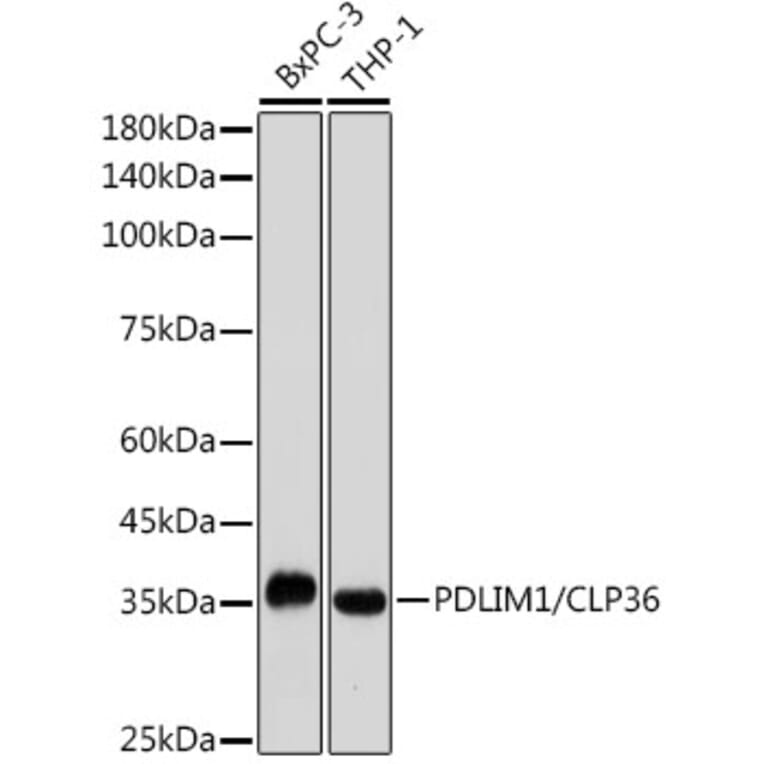 Western Blot - Anti-PDLIM1/CLP36 Antibody [ARC2379] (A306687) - Antibodies.com