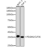 Western Blot - Anti-PDLIM1/CLP36 Antibody [ARC2379] (A306687) - Antibodies.com