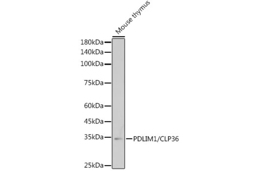 Western Blot - Anti-PDLIM1/CLP36 Antibody [ARC2379] (A306687) - Antibodies.com