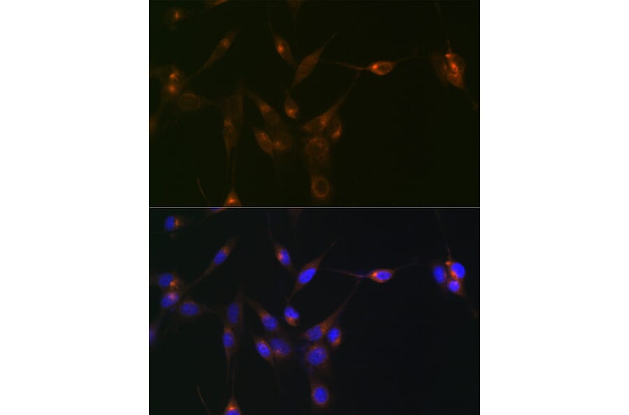 Immunofluorescence - Anti-PDLIM1/CLP36 Antibody [ARC2379] (A306687) - Antibodies.com
