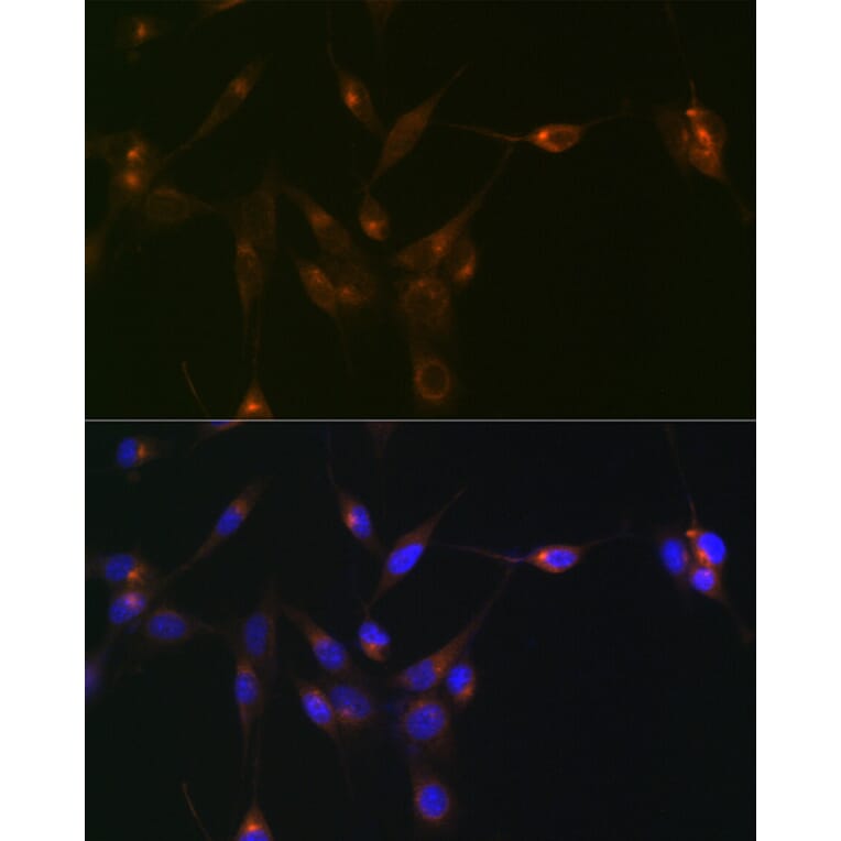 Immunofluorescence - Anti-PDLIM1/CLP36 Antibody [ARC2379] (A306687) - Antibodies.com