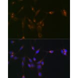 Immunofluorescence - Anti-PDLIM1/CLP36 Antibody [ARC2379] (A306687) - Antibodies.com