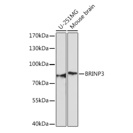 Western Blot - Anti-FAM5C Antibody (A306688) - Antibodies.com