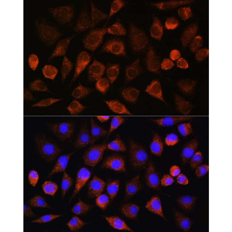 Immunofluorescence - Anti-FAM5C Antibody (A306688) - Antibodies.com