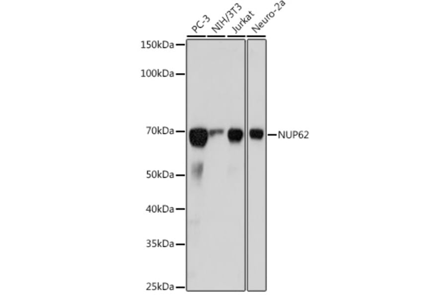 Western Blot - Anti-Nucleoporin p62/NUP62 Antibody [ARC2444] (A306689) - Antibodies.com