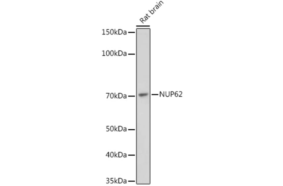Western Blot - Anti-Nucleoporin p62/NUP62 Antibody [ARC2444] (A306689) - Antibodies.com