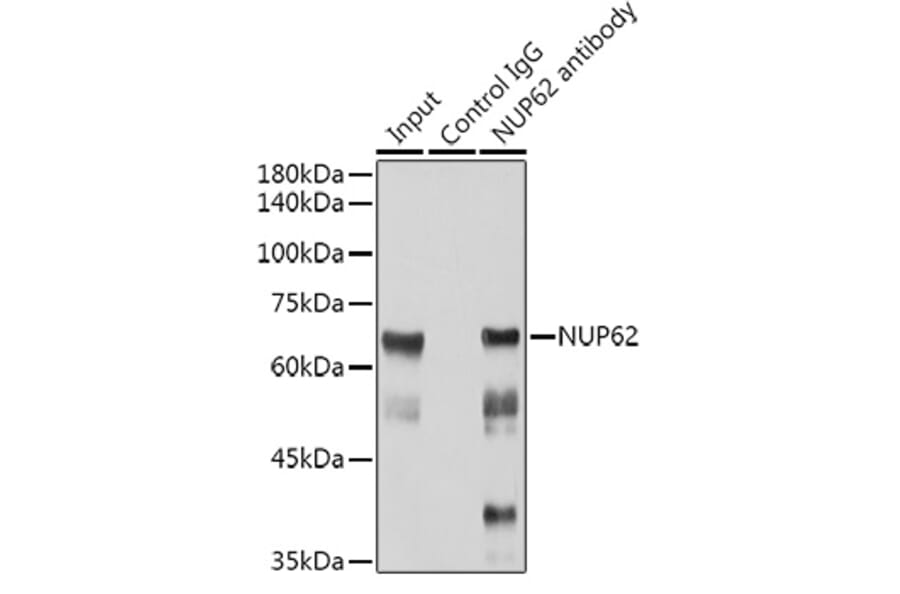 Western Blot - Anti-Nucleoporin p62/NUP62 Antibody [ARC2444] (A306689) - Antibodies.com