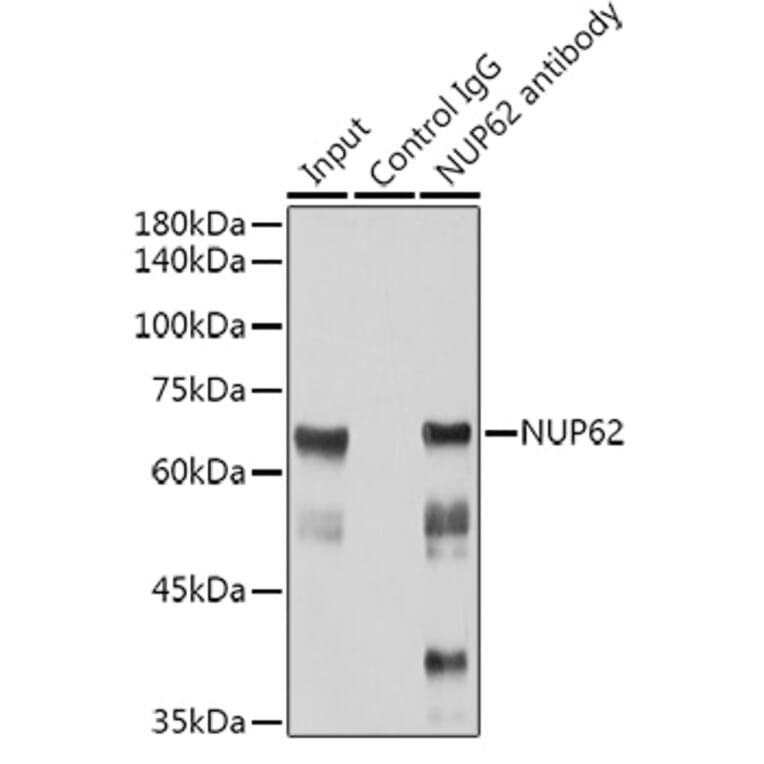 Western Blot - Anti-Nucleoporin p62/NUP62 Antibody [ARC2444] (A306689) - Antibodies.com