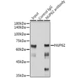 Western Blot - Anti-Nucleoporin p62/NUP62 Antibody [ARC2444] (A306689) - Antibodies.com