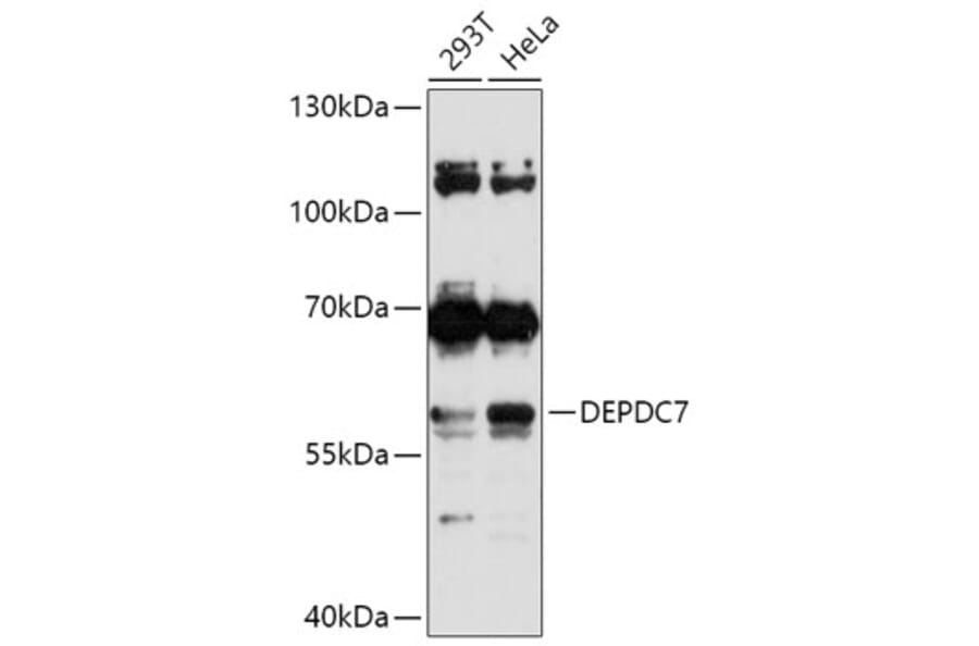 Western Blot - Anti-DEPDC7 Antibody (A306690) - Antibodies.com