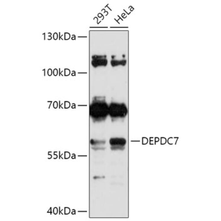 Western Blot - Anti-DEPDC7 Antibody (A306690) - Antibodies.com