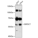 Western Blot - Anti-DEPDC7 Antibody (A306690) - Antibodies.com