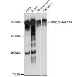 Western Blot - Anti-BRG1 Antibody [ARC0035] (A306691) - Antibodies.com