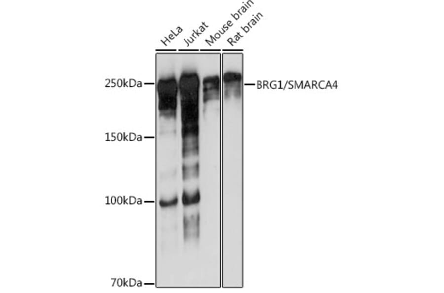 Western Blot - Anti-BRG1 Antibody [ARC0035] (A306691) - Antibodies.com