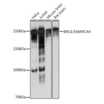 Western Blot - Anti-BRG1 Antibody [ARC0035] (A306691) - Antibodies.com