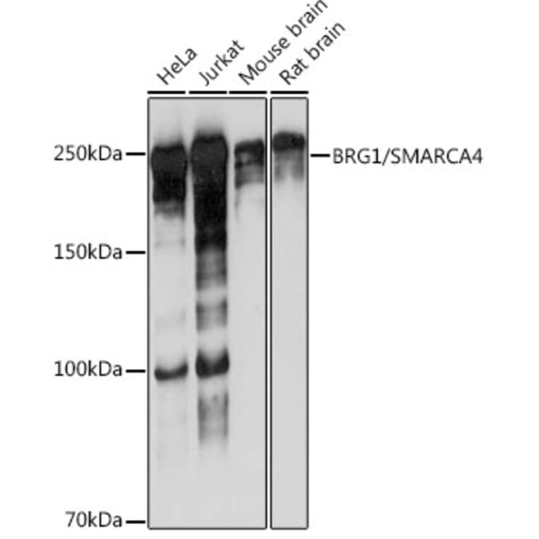 Western Blot - Anti-BRG1 Antibody [ARC0035] (A306691) - Antibodies.com