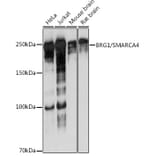 Western Blot - Anti-BRG1 Antibody [ARC0035] (A306691) - Antibodies.com