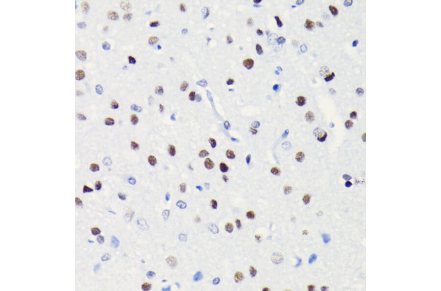 Immunohistochemistry - Anti-BRG1 Antibody [ARC0035] (A306691) - Antibodies.com
