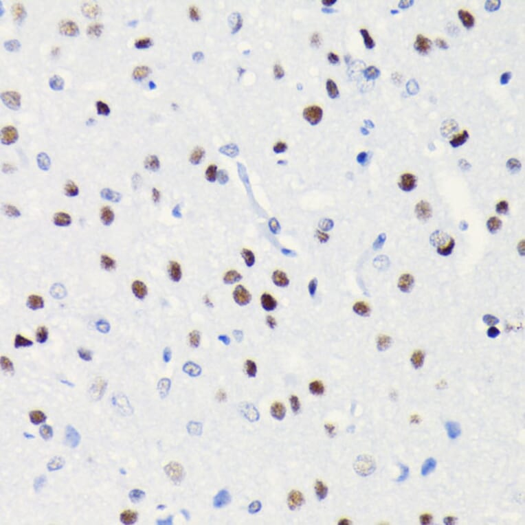 Immunohistochemistry - Anti-BRG1 Antibody [ARC0035] (A306691) - Antibodies.com