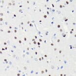 Immunohistochemistry - Anti-BRG1 Antibody [ARC0035] (A306691) - Antibodies.com