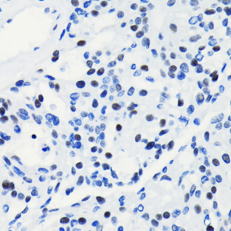 Immunohistochemistry - Anti-BRG1 Antibody [ARC0035] (A306691) - Antibodies.com