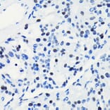 Immunohistochemistry - Anti-BRG1 Antibody [ARC0035] (A306691) - Antibodies.com