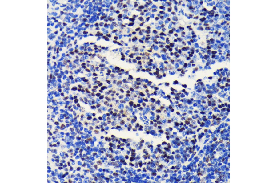 Immunohistochemistry - Anti-BRG1 Antibody [ARC0035] (A306691) - Antibodies.com