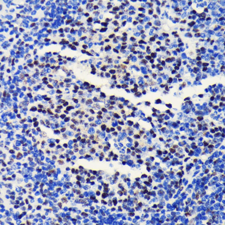 Immunohistochemistry - Anti-BRG1 Antibody [ARC0035] (A306691) - Antibodies.com