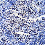 Immunohistochemistry - Anti-BRG1 Antibody [ARC0035] (A306691) - Antibodies.com