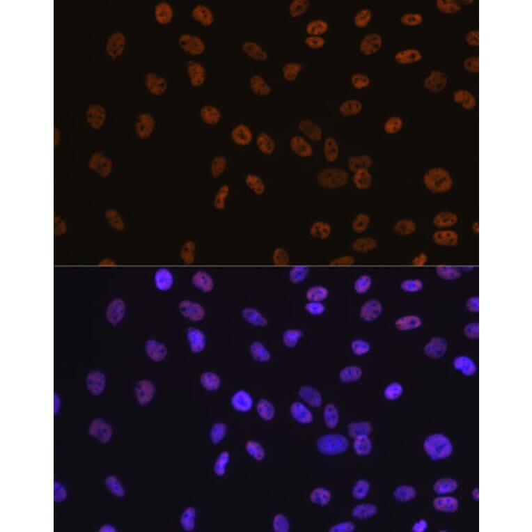 Immunofluorescence - Anti-BRG1 Antibody [ARC0035] (A306691) - Antibodies.com