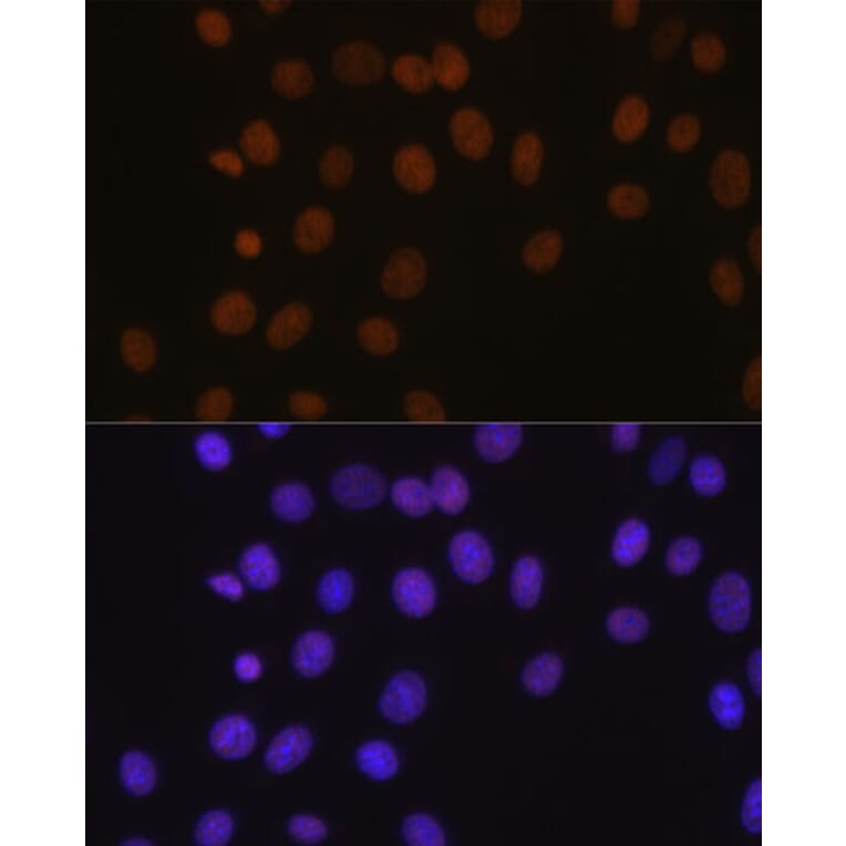 Immunofluorescence - Anti-BRG1 Antibody [ARC0035] (A306691) - Antibodies.com