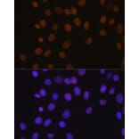 Immunofluorescence - Anti-BRG1 Antibody [ARC0035] (A306691) - Antibodies.com