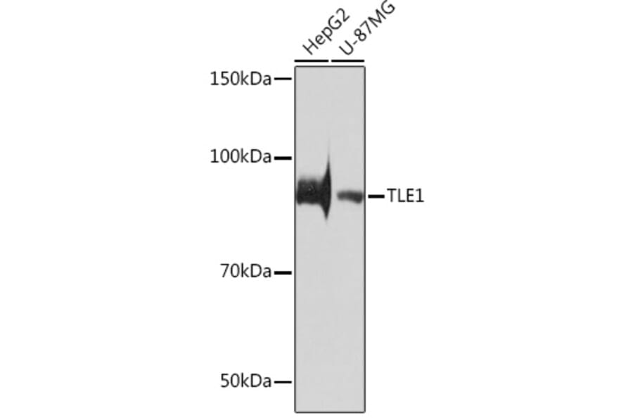 Western Blot - Anti-TLE 1 Antibody [ARC0793] (A306693) - Antibodies.com