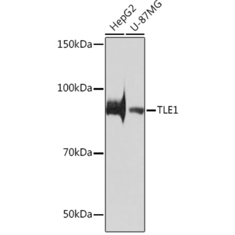 Western Blot - Anti-TLE 1 Antibody [ARC0793] (A306693) - Antibodies.com