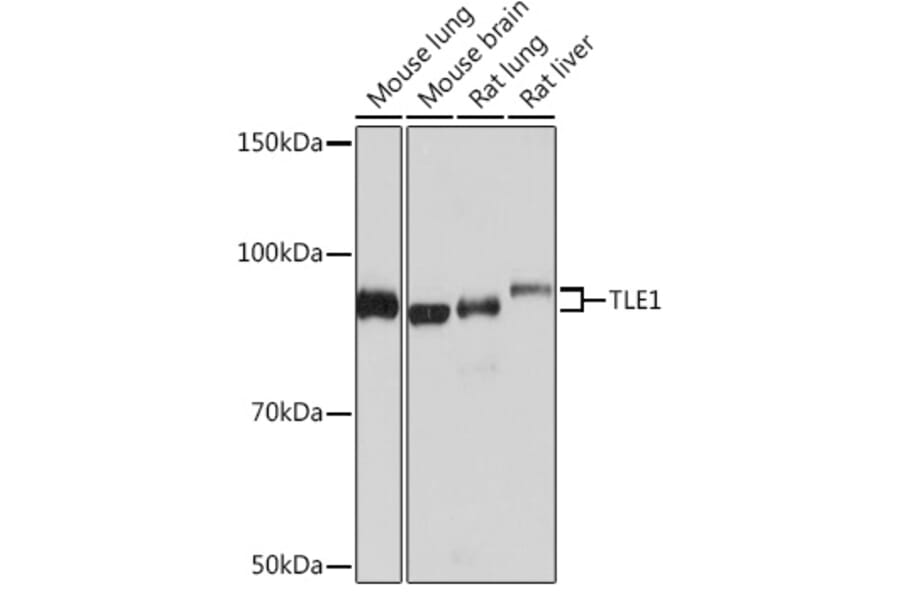 Western Blot - Anti-TLE 1 Antibody [ARC0793] (A306693) - Antibodies.com